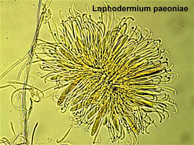 Lophodermium paeoniae-amf2072-asques et paraphyses.jpg - Lophodermium paeoniae ; Nom français: Lophodermie de la pivoine